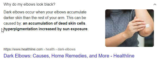 2021-09-17 18_11_16-black elbows diabetes - Google Search - Brave.png